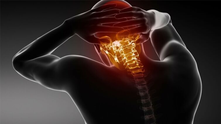fájdalom a fej hátsó részén nyaki osteochondrosissal