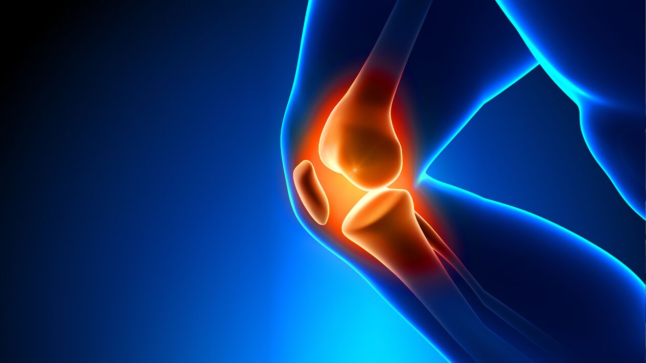 ízületi arthrosis