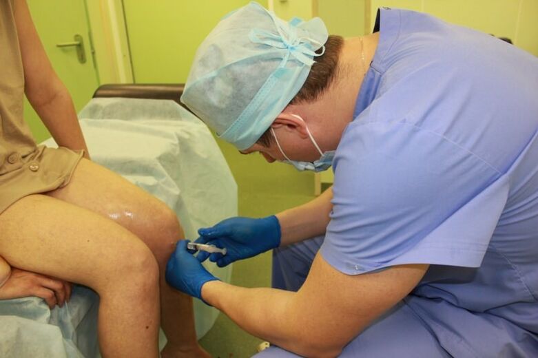 Az intraartikuláris injekció a végső megoldás nagyon súlyos térdsérülések esetén